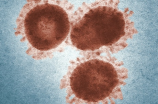 最新研究称布尼亚病毒会引起人类颅内出血